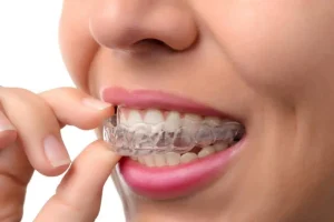 a person is using a clear orthodontic aligner, Invisalign, which is nearly transparent