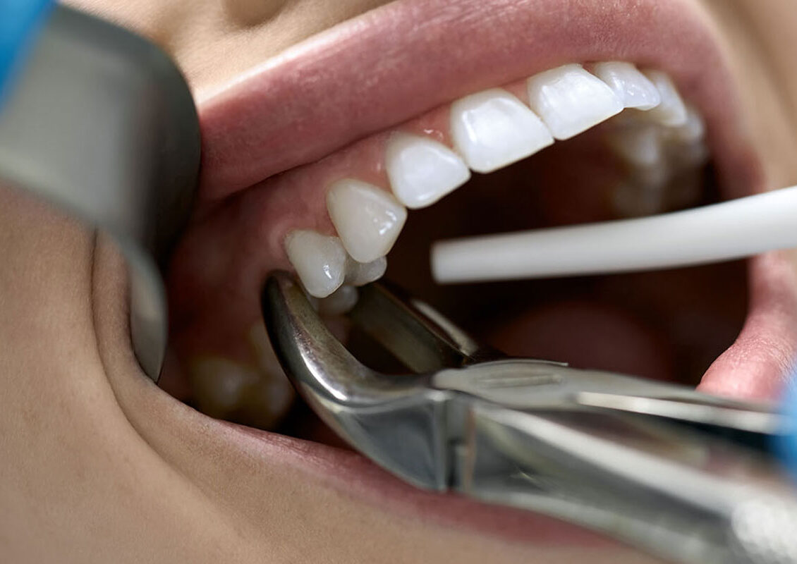 Acer Dental Clinic: Your Partner in Modern Dentistry