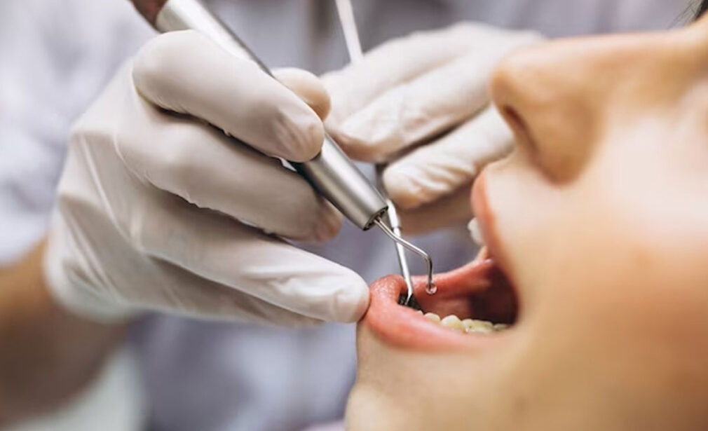 dental examination of the lower jaw with dental tools for root canal treatment