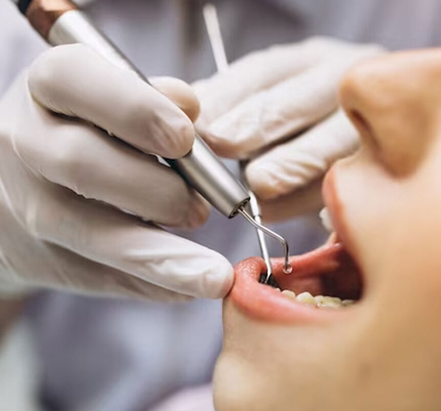 dental examination of the lower jaw with dental tools for root canal treatment