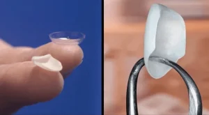 veneers in dubai