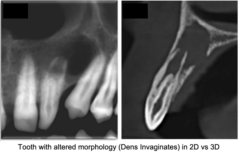 What Is a CBCT Scan? Uses, Benefits & When You Need One