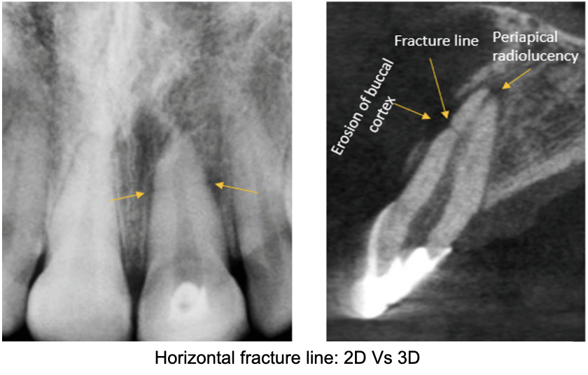 What Is a CBCT Scan? Uses, Benefits & When You Need One
