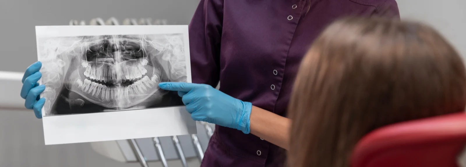 Impacted Tooth
