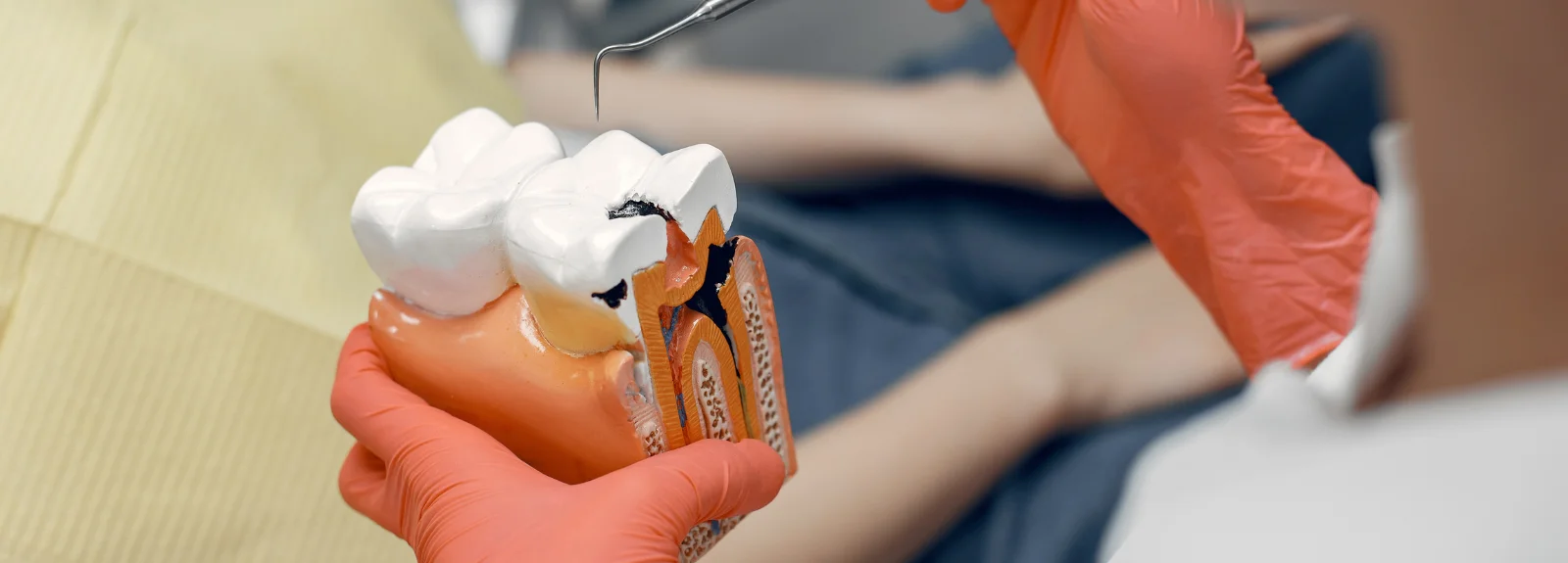 Root Canal Treatment